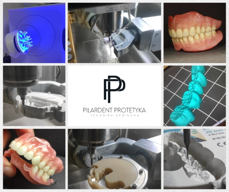 Technologia modele cyfrowe zębów
